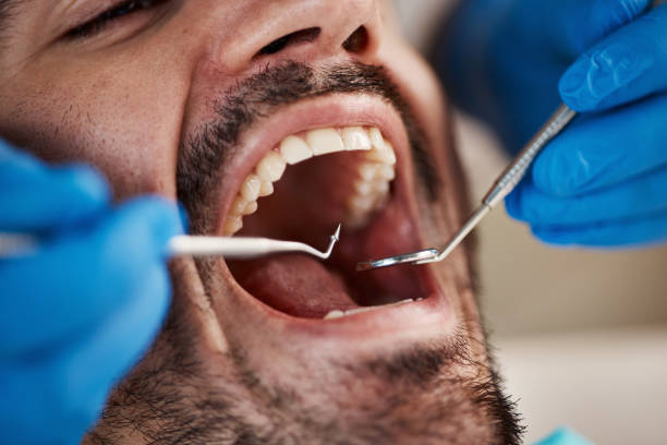 Best Emergency Denture Repair in Julesburg, CO